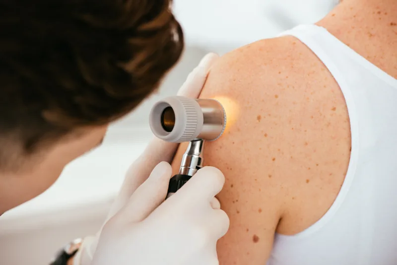 Dermatología